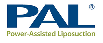 Power Assisted Liposuction Micro Aire PAL 650 Kinetics Plus